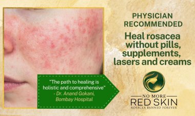 No More Red Skin: Revolutionizing The Rosacea Narrative in India
